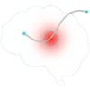 Oculoplasty