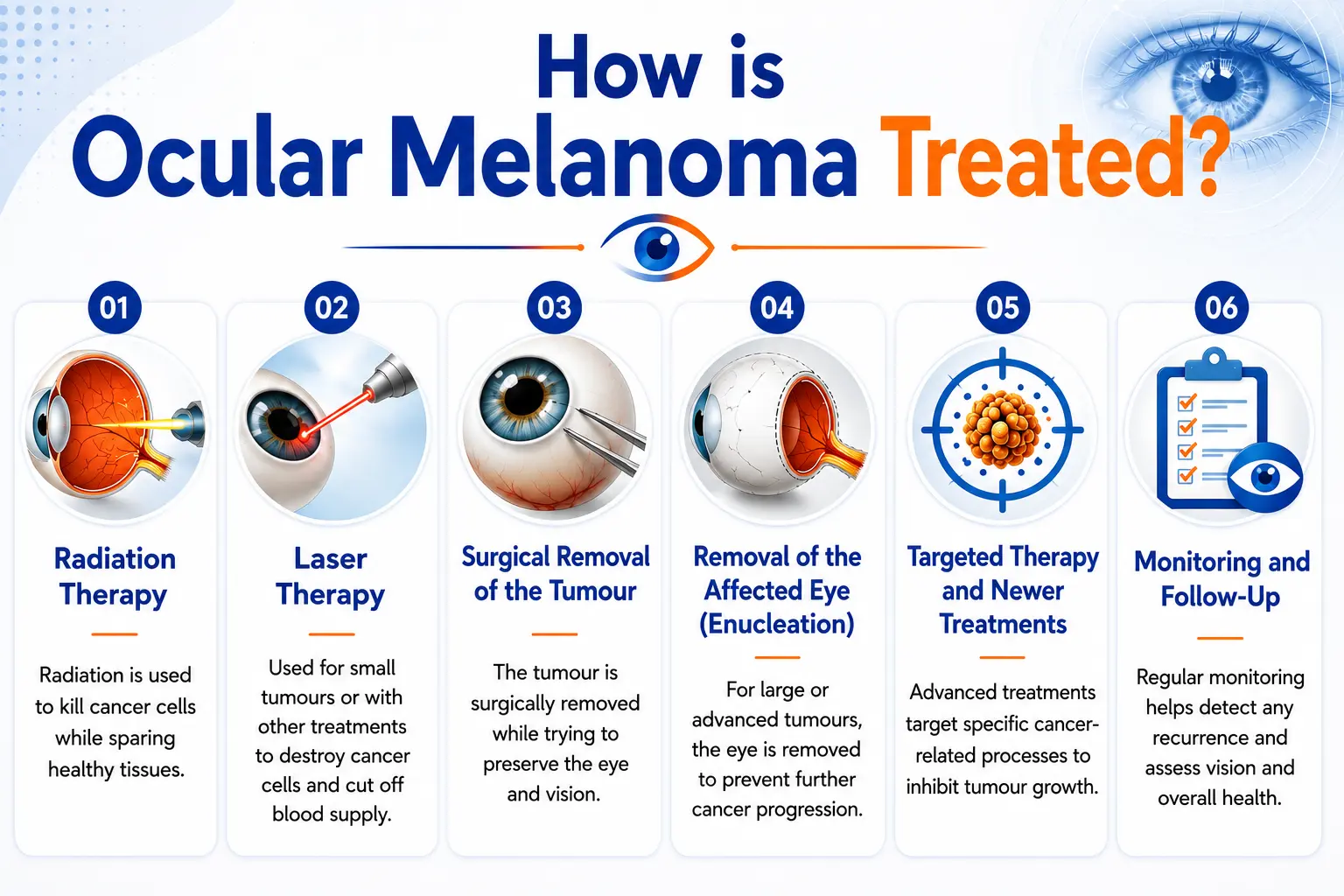 Landscape infographic explaining the treatment options for ocular melanoma, including radiation therapy, laser therapy, surgical tumour removal, enucleation (eye removal), targeted therapy, and regular monitoring and follow-up. Each treatment is illustrated with a medical icon and brief description on a clean blue-and-orange themed background.