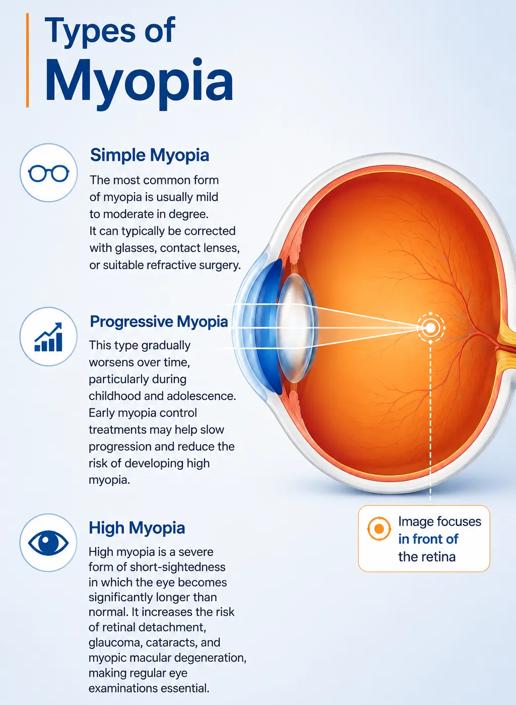 Types of myopia explained in infographic in orange and blue theme