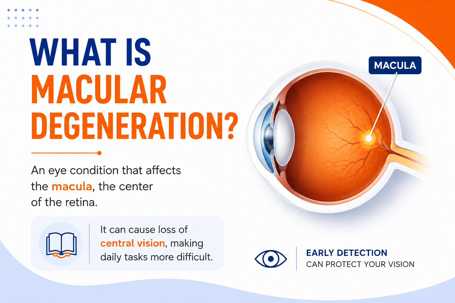 Medical illustration showing the macula, the central part of the retina responsible for sharp, detailed vision.