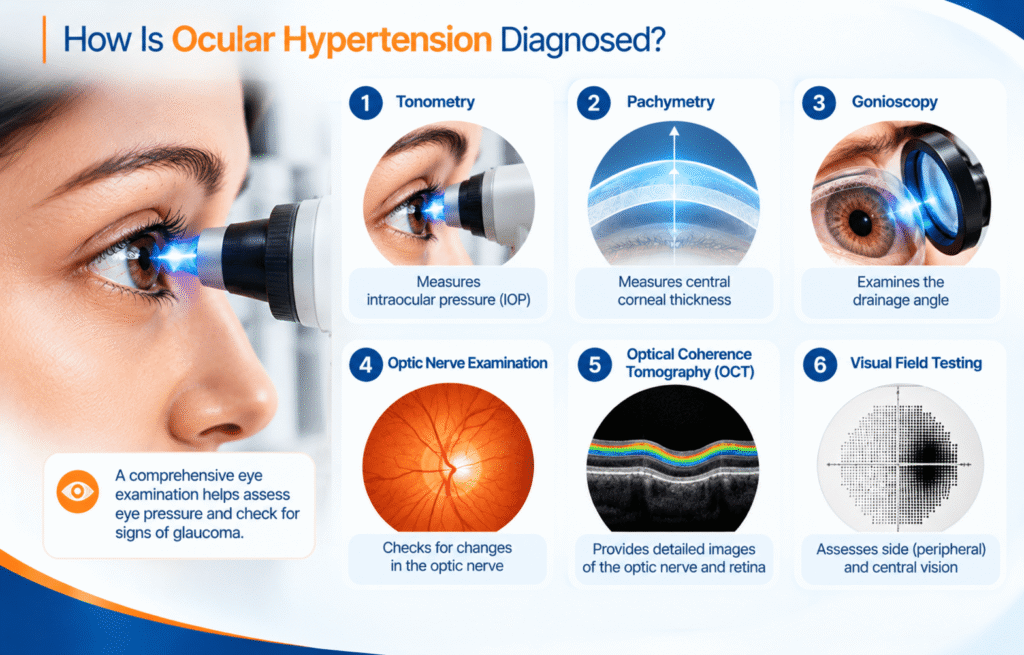 Diagnostic tests for ocular hypertension, including tonometry, pachymetry, gonioscopy, OCT and visual field testing